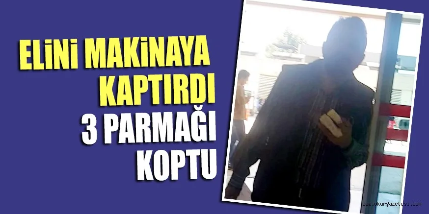 3 PARMAĞI KOPTU