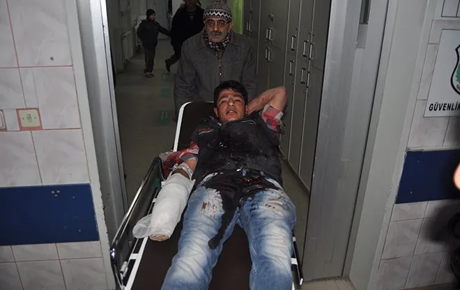 Suriyeli işçi elini makineye kaptırdı