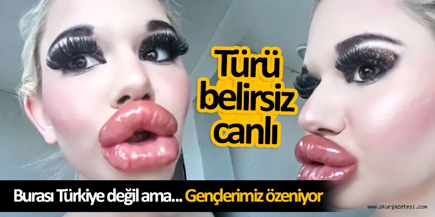 Barbie'ye benzemek isteyen genç kız dudağına 20'den fazla dolgu yaptırdı