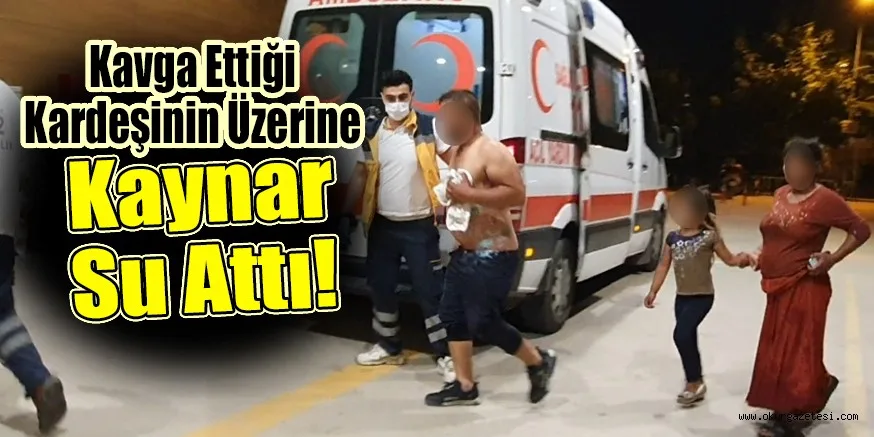 Kardeşini Kaynar Su ile Yaraladı