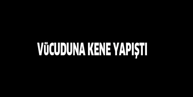 VüCUDUNA KENE YAPIŞTI