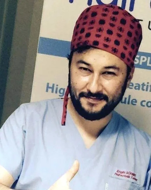 Saç Ekiminde Uzman Tecrübesine Dikkat