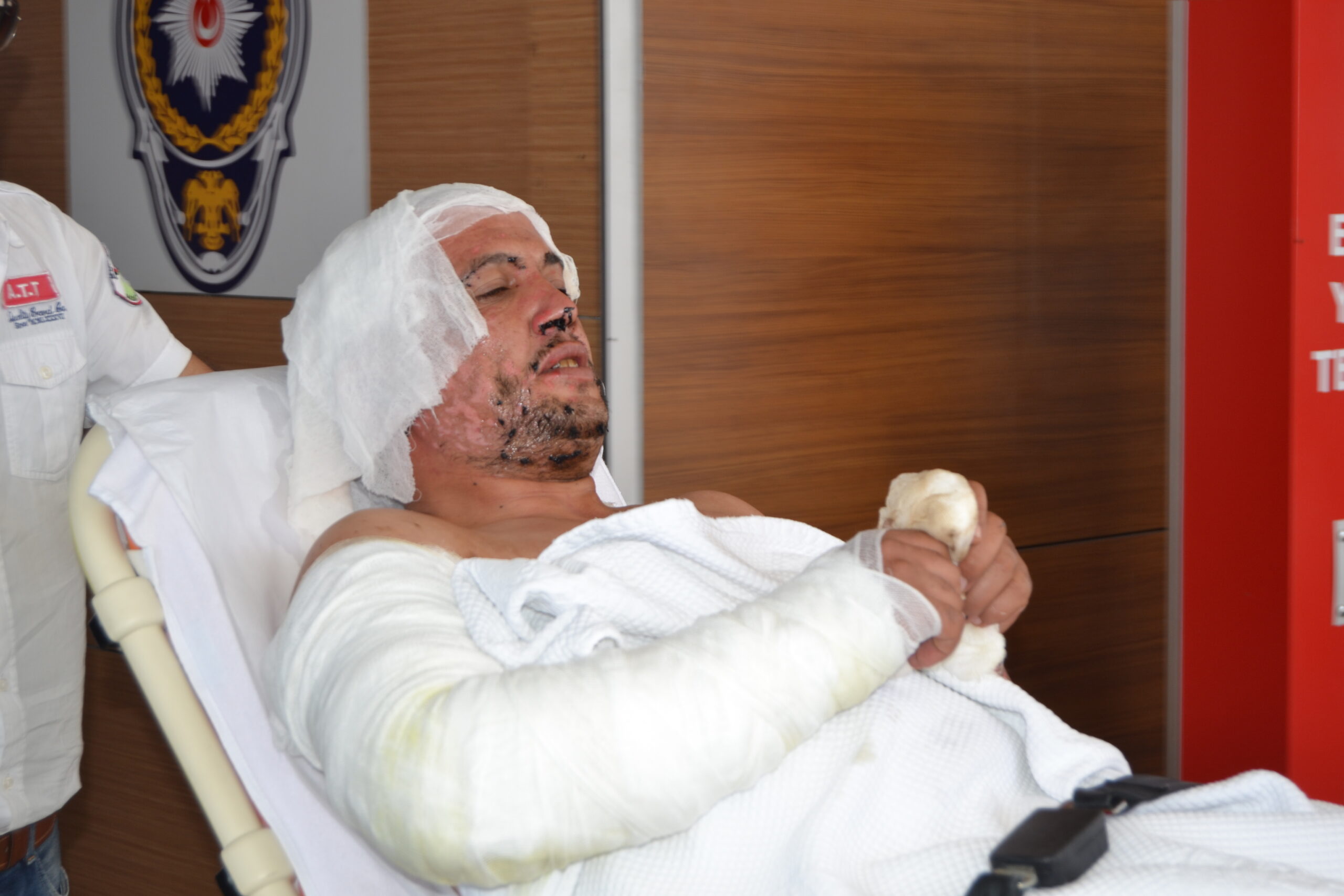 Üzerine zift döküldü