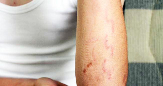 Eşinin yakınları zincirle dövdü