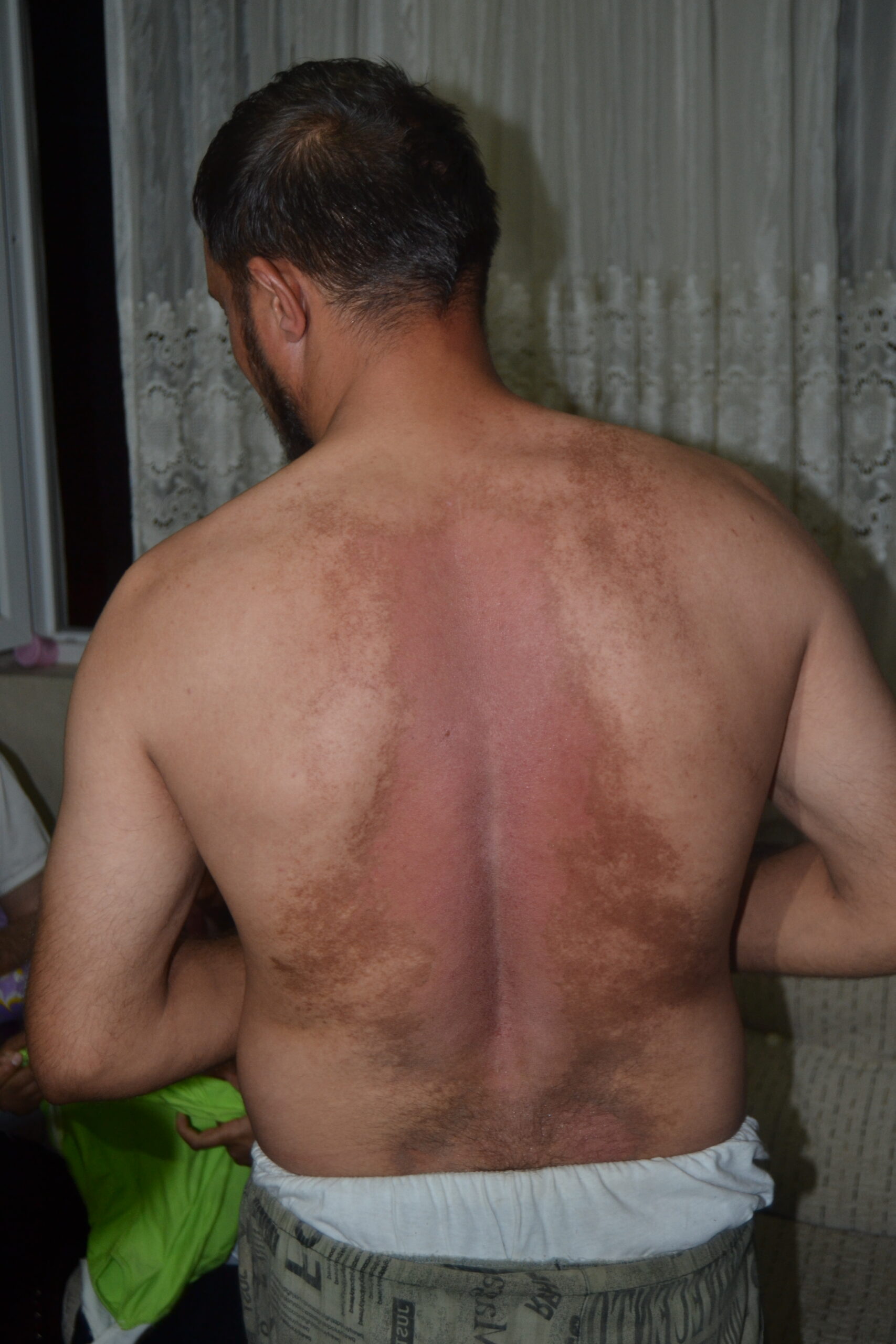 Suriyeli aile tedavi olmak istiyor