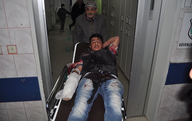 Suriyeli işçi elini makineye kaptırdı