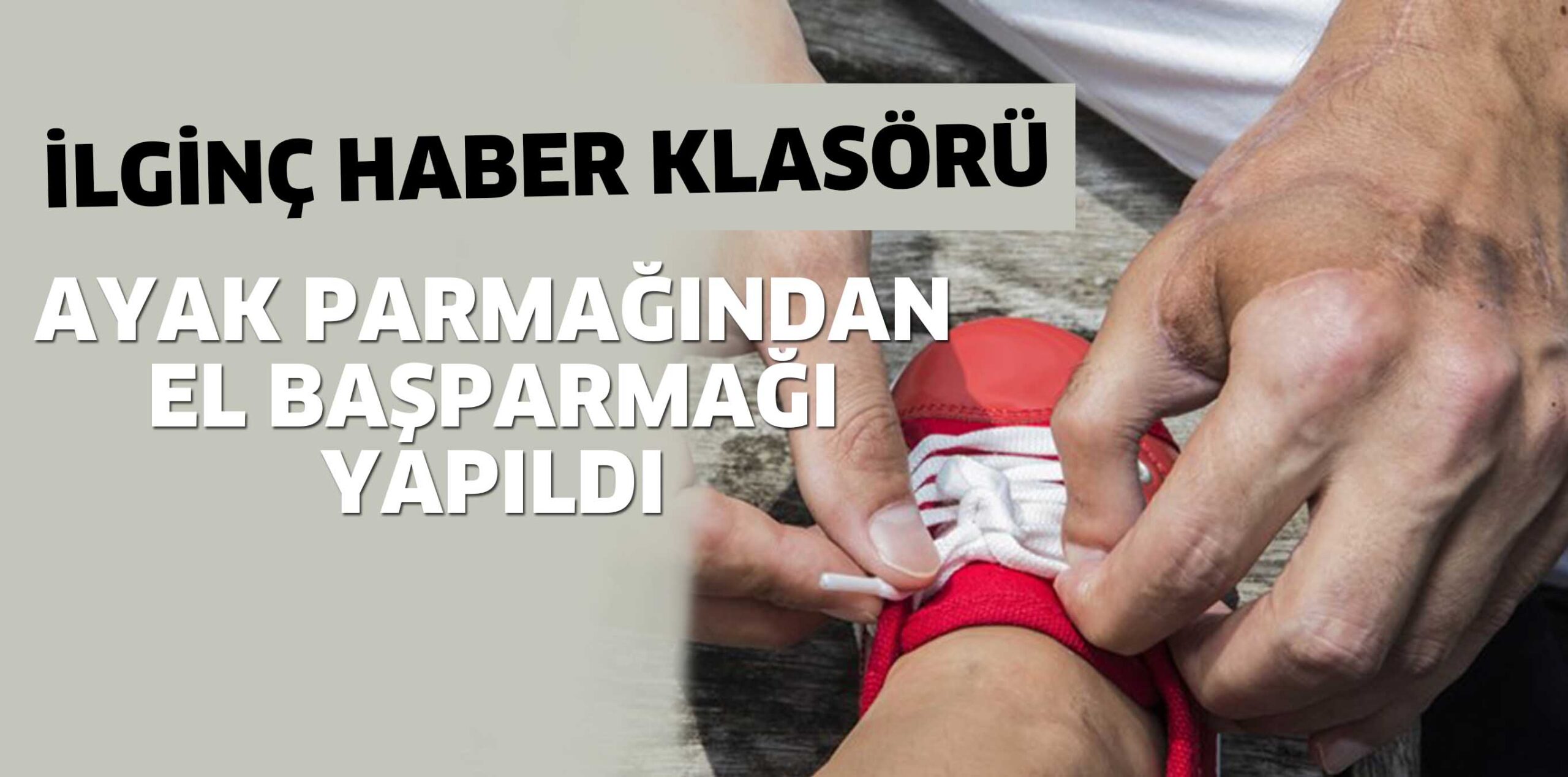 Ayak parmağından el başparmağı yapıldı!