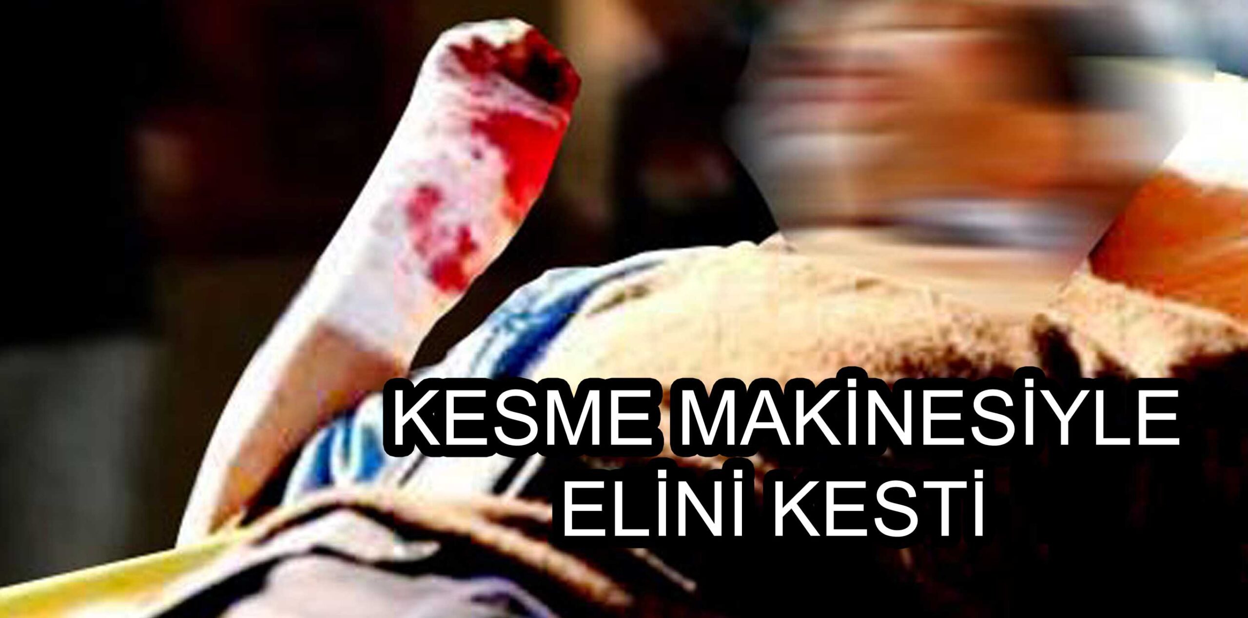 KESME MAKİNESİYLE ELİNİ KESTİ
