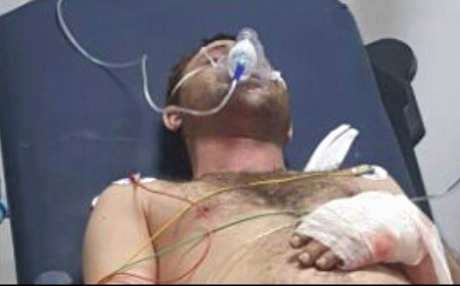 Samsunda Tüp Patladı: 1 Yaralı