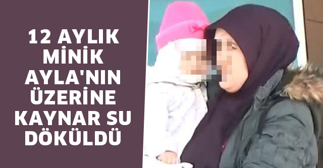 12 AYLIK MİNİK AYLA’NIN ÜZERİNE KAYNAR SU DÖKÜLDÜ