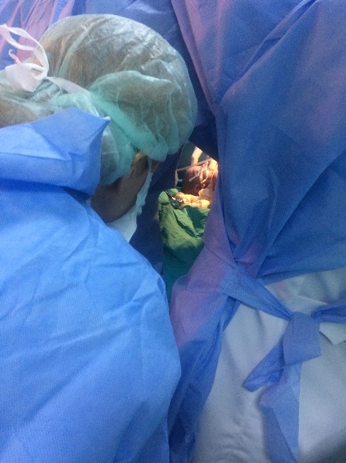 Diyarbakırlı Ailenin Siyam İkizleri Ankarada Dünyaya Geldi