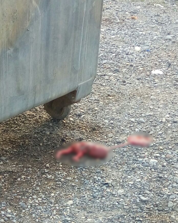 İzmirde Çöp Konteynerinde Cenin Bulundu