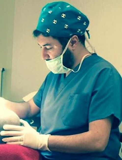 Saç Ekimi Kabusunuz Olmasın