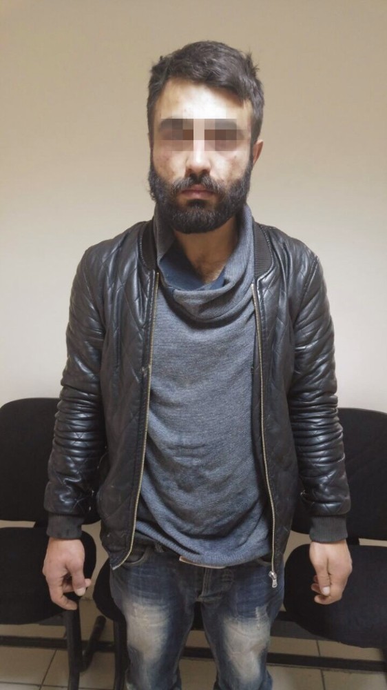 Arkadaşının Yüzünü Bu Hale Getirdi