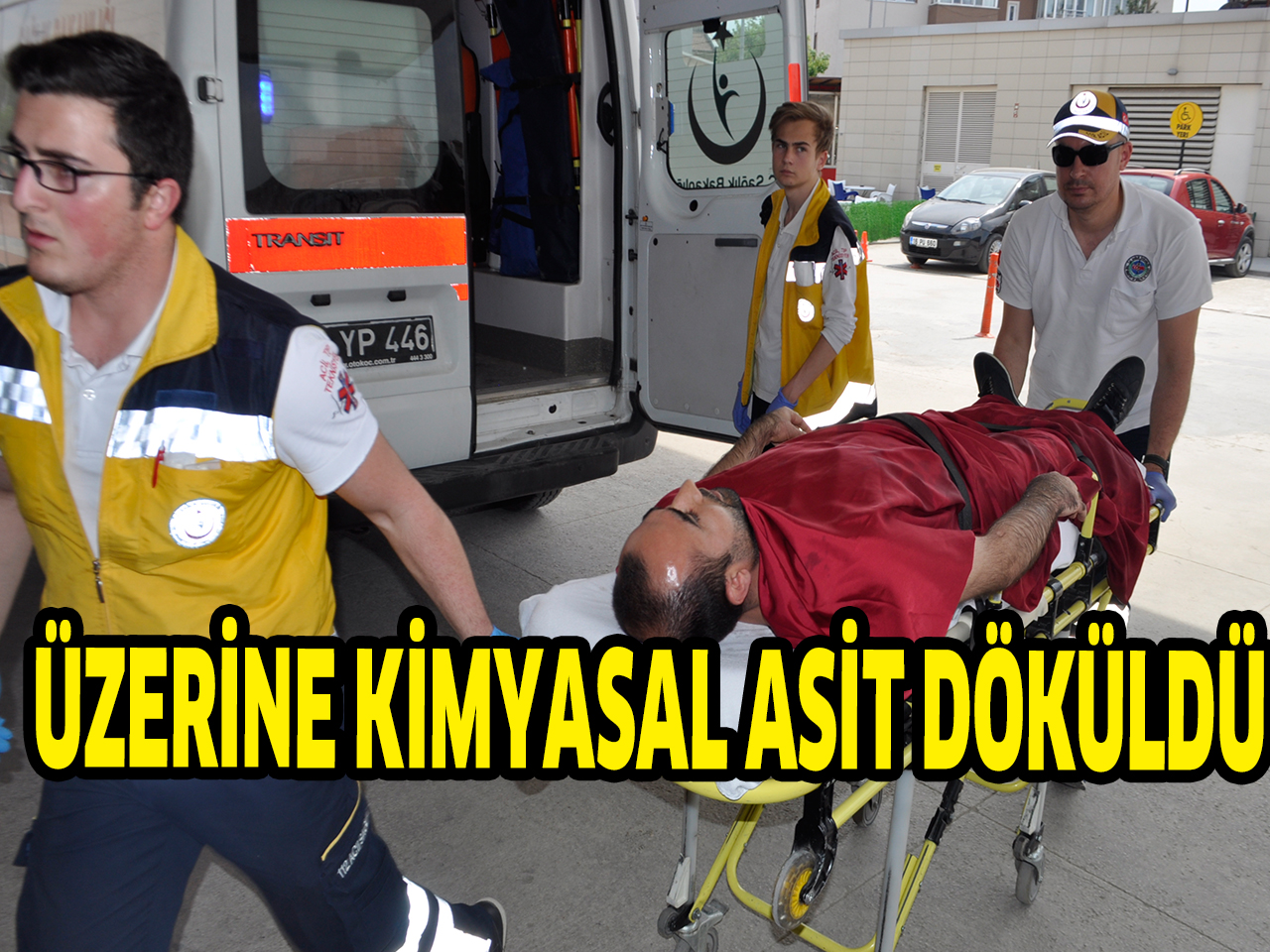 ÜZERİNE KİMYASAL ASİT DÖKÜLDÜ