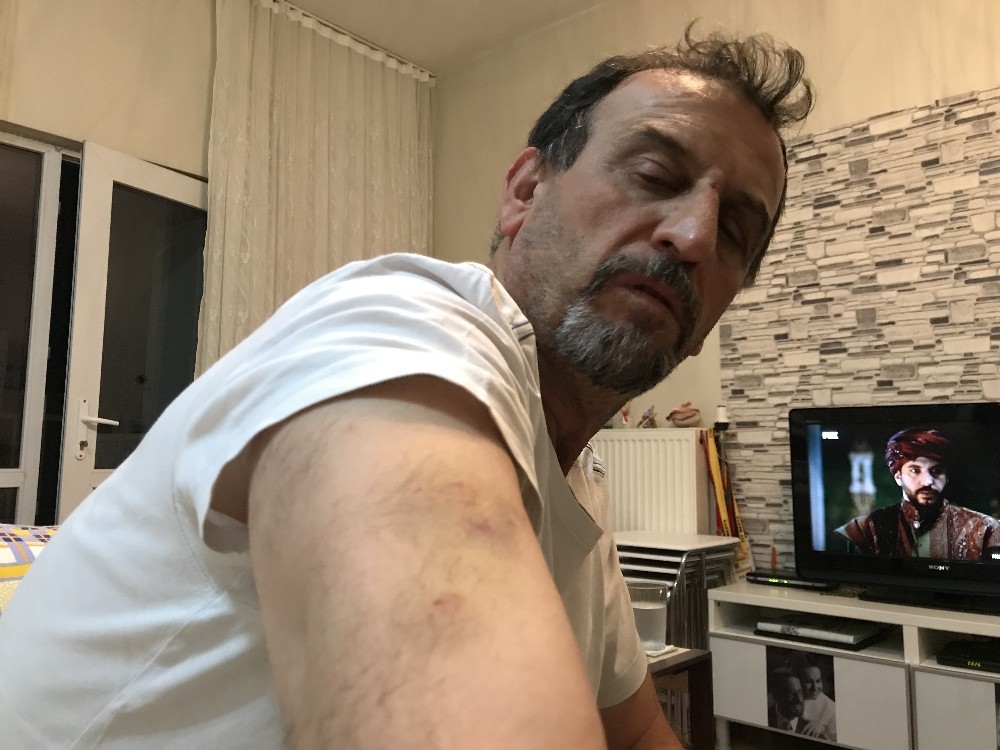 Engelli Yoluna Park Etme Dediği İçin Linç Edildi..