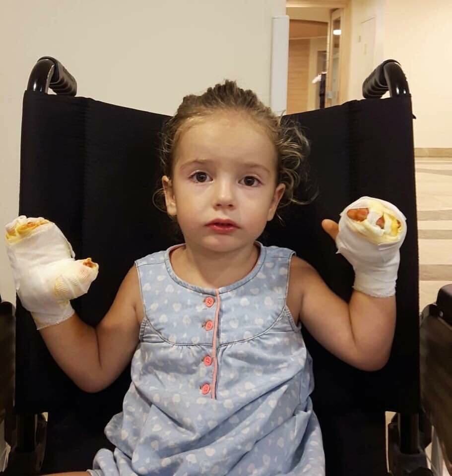 İçinde Yanıcı Gaz Bulunan Uçan Balon Küçük Kızı Yaktı