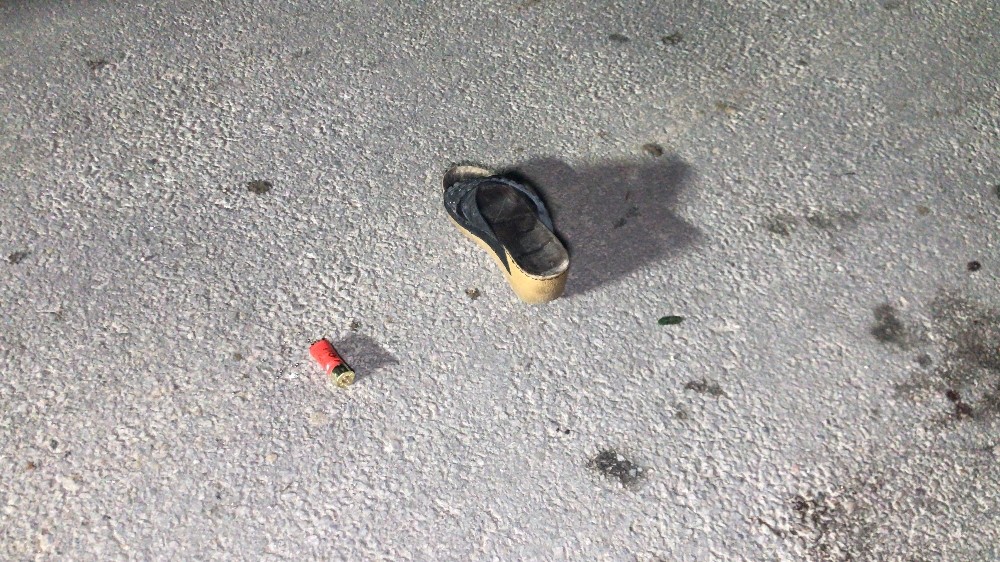 Silahlı Kavga Arasından Kalan Kadın Ağır Yaralandı