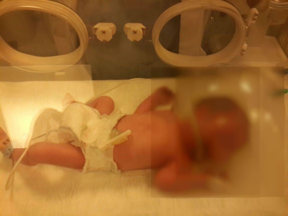 (Özel Haber) Henüz Doğmadığı İçin Annesinin Öldüğü Kaza Davasında Birey Sayılmayan Kaan Bebek İçin Büyük Mücadele