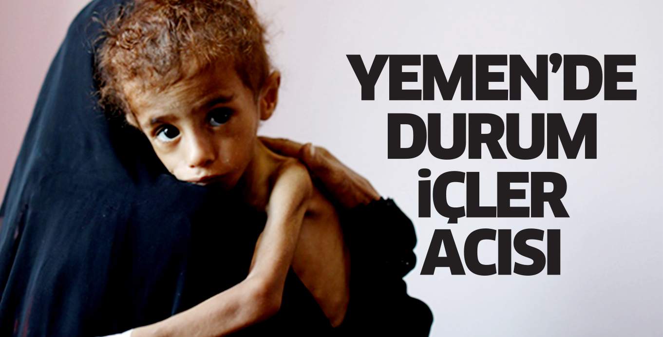 YEMEN’DE DURUM  iÇLER ACISI