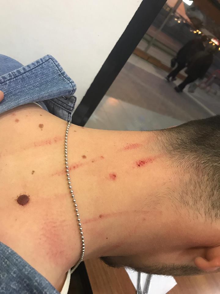 iNEGöLLü FUTBOLCULARI  RESMEN BiÇTiLER