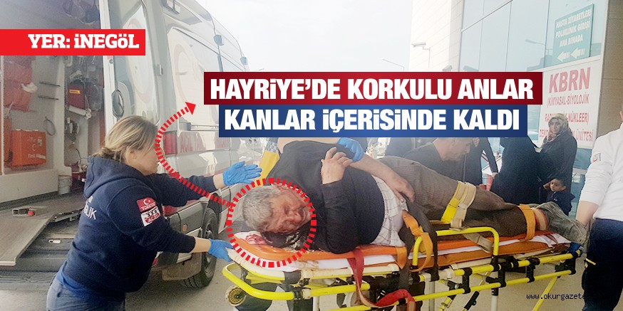 YüZüNDEN YARALANDI