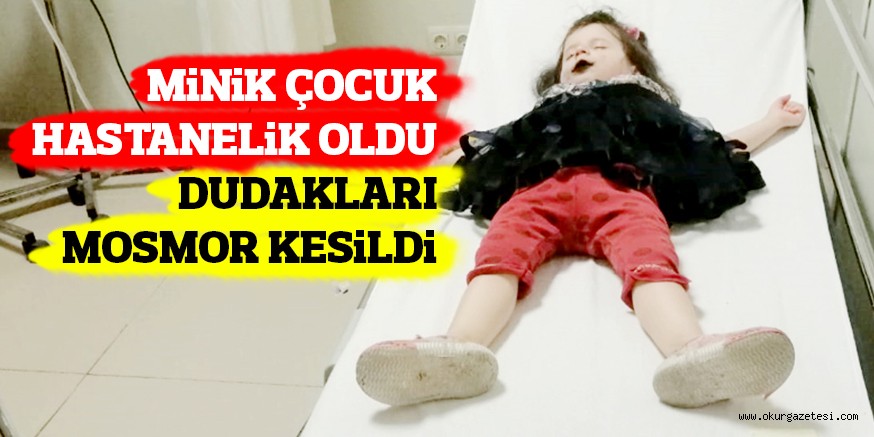 MiNiK ÇOCUK HASTANELiK OLDU DUDAKLAR MOSMOR KESiLDi