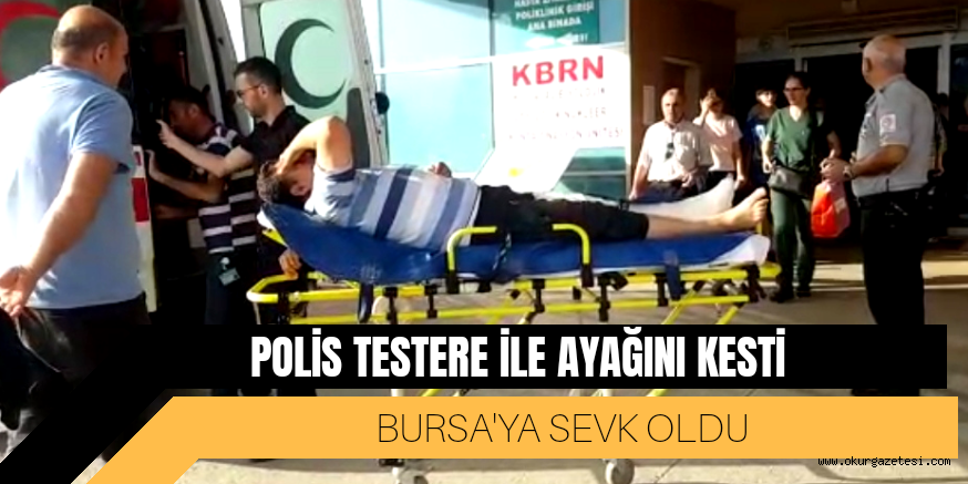 İNEGÖLLÜ POLİS AYAĞINI KESTİ