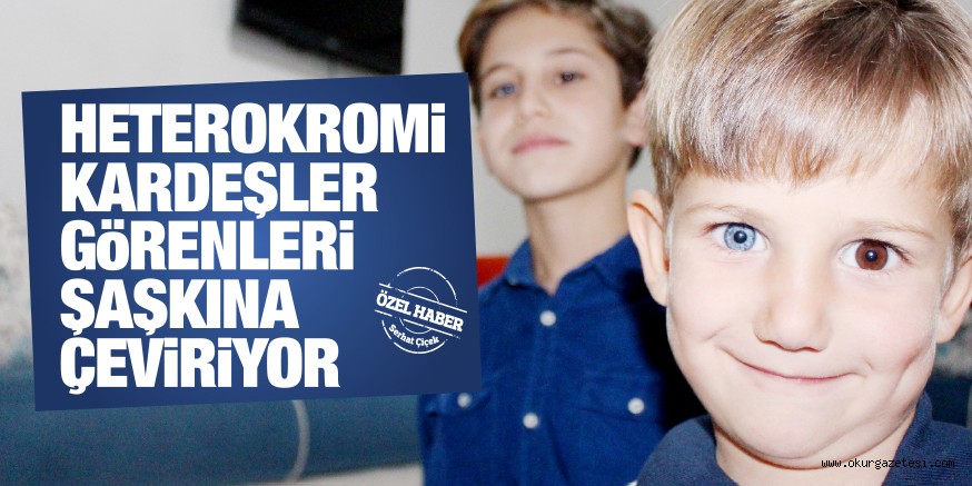 HETEROKROMİ KARDEŞLER GÖRENLERİ ŞAŞKINA ÇEVİRİYOR