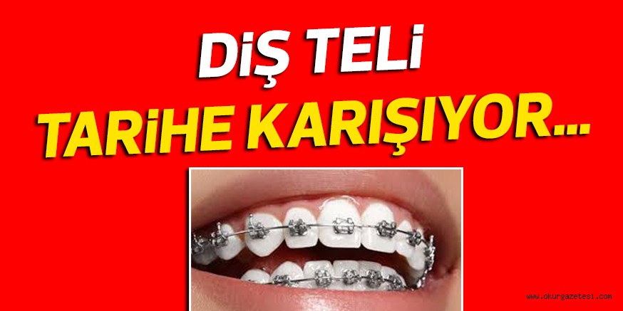 DiŞ TELi TARiHE KARIŞIYOR…