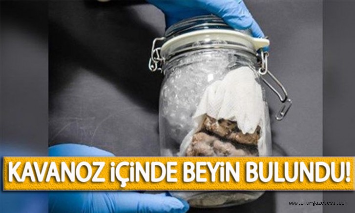 KAVANOZ iÇiNDE BEYiN BULUNDU!
