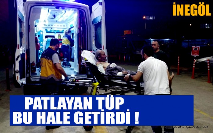 YÜZÜNE TÜP PATLADI