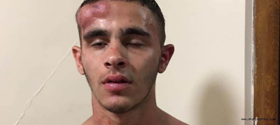 O KANSIZLAR YAKALANDI