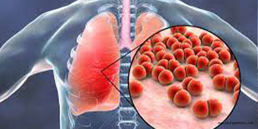 Bursa’da virüslere karşı geliştirilen spreyin, zatürreyi de engellediği saptandı