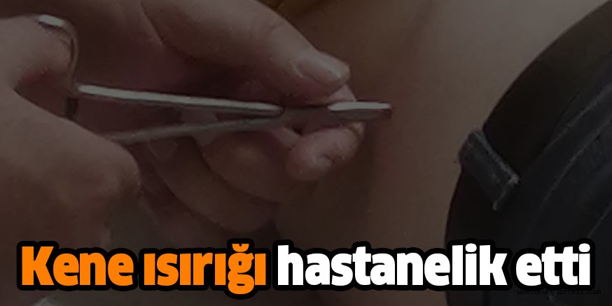 Kene ısırığı hastanelik etti