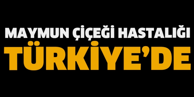 Son Dakika: Bakan Koca kötü haberi verdi! Türkiye’de ilk maymun çiçeği vakasına rastlandı