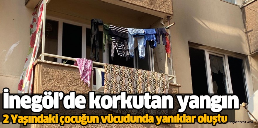 İnegöl’de korkutan yangın 2 Yaşındaki çocuğun vücudunda yanıklar oluştu