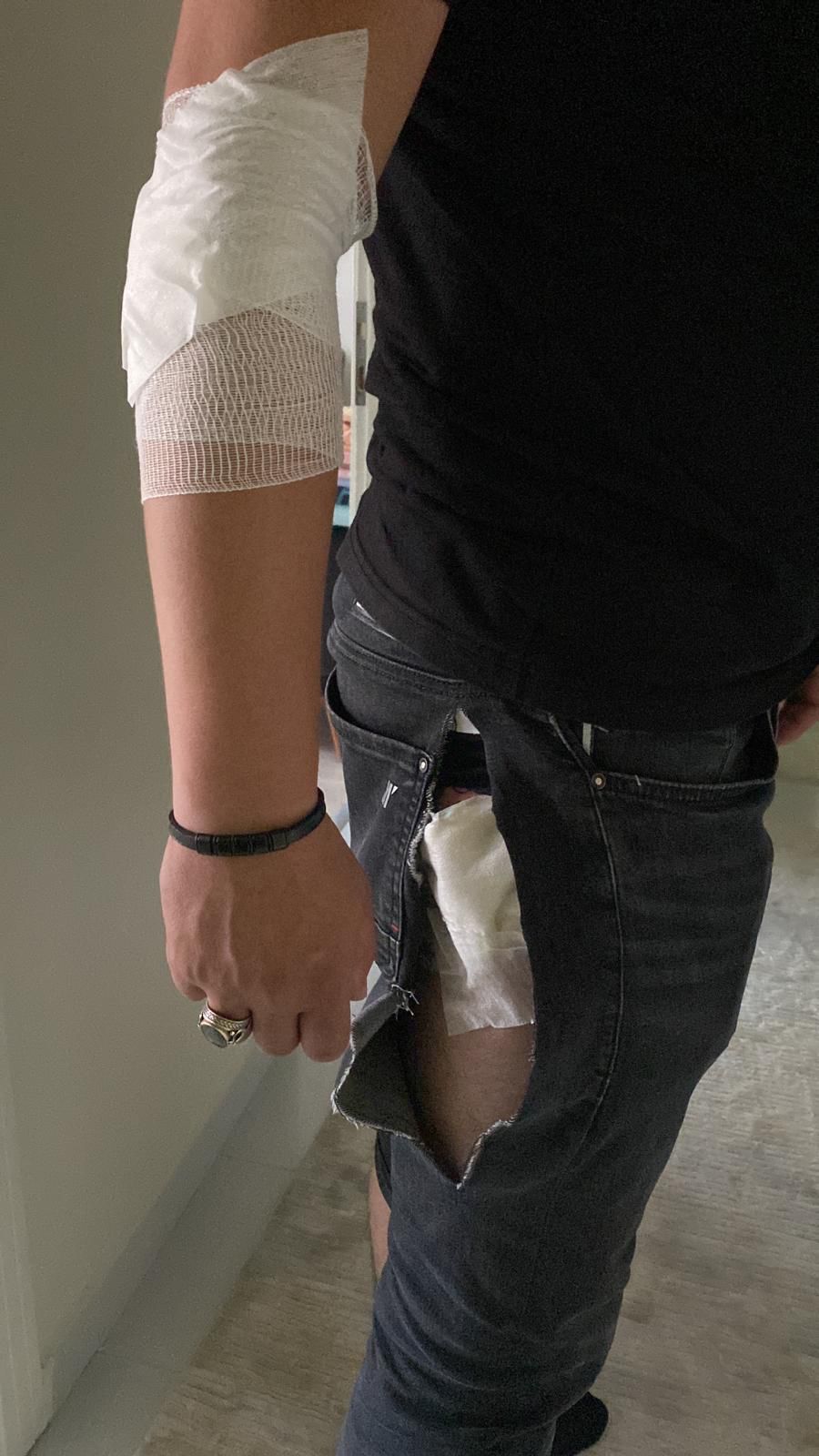 İnegöllü iş insanı ölümden döndü