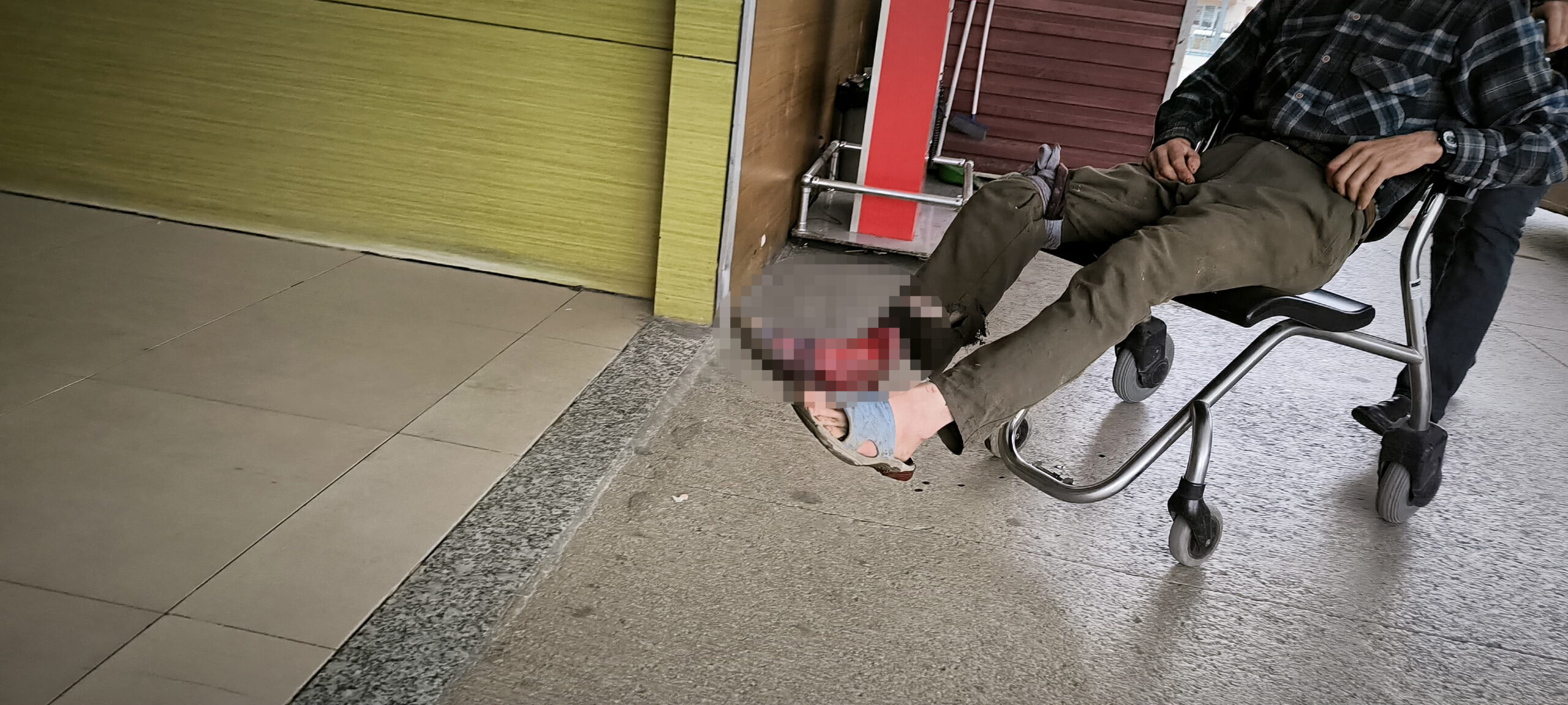 Motorlu testere ile yanlışlıkla kendini kesti