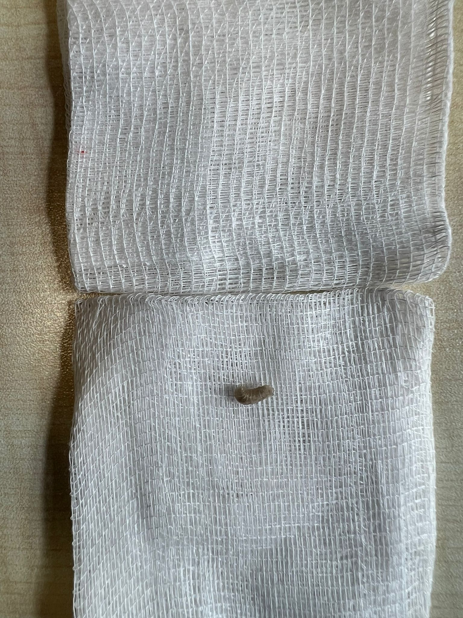 Ağrı şikayetiyle hastaneye götürülen çocuğun kulağından 2 kurtçuk çıkarıldı