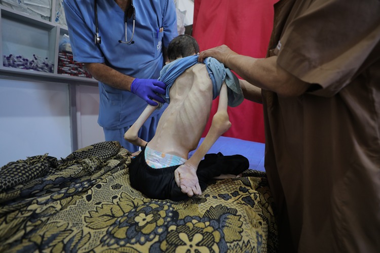 Gazze’de açlıktan ölümler artarak devam ediyor  İHH İnegöl Temsilciliği’nden yardım çağrısı