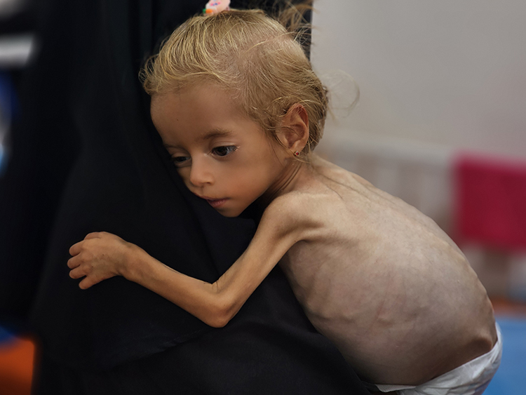 “Gazze için az çok demeden tüm İnegöl’ün desteğine ihtiyacımız var”