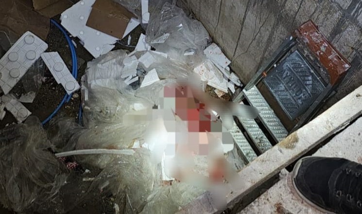 21 Yaşındaki genç yaşam savaşı veriyor