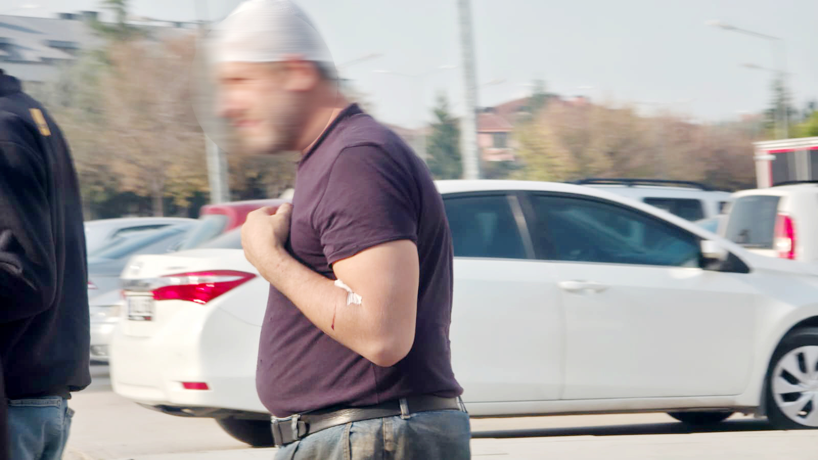 Başına demir parçası düşen işçi yaralandı