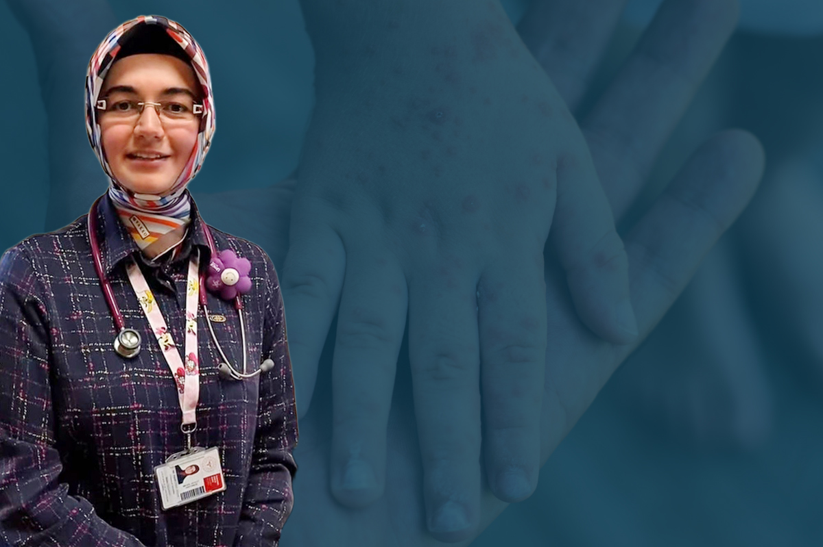 İnegöl Devlet Hastanesi Çocuk Sağlığı ve Hastalıkları Uzmanı Dr. Ferahnur Karaman’dan ‘El, ayak, ağız hastalığı’ uyarısı